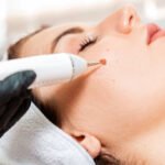 Effective laser hair reduction Treatments: A Comprehensive Guide to Achieving Smooth Skin