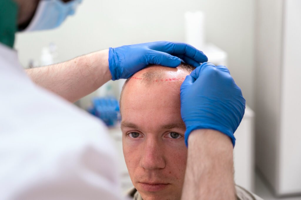 hair transplant cost in jaipur