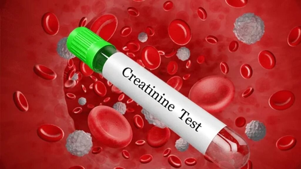 Creatinine Test