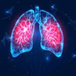 Lung Cancer Screening Market Size And Forecast Report 2024-2032