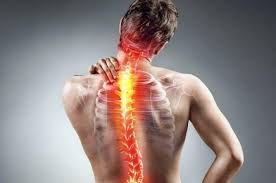 nerve pain